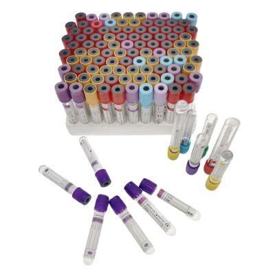 High Quality Tube EDTA K3 K2 Vacuum Blood Collection Tube