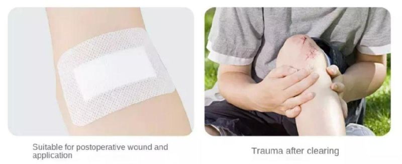 Medical Wound Dressing for Wound Healing Highly Absorbent Dressing Sterile Individual Wrapped for Wound Care