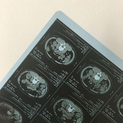 A4, 8*10, 10*12, 14*17 Inch for Hospital Inkjet Medical X-ray Film