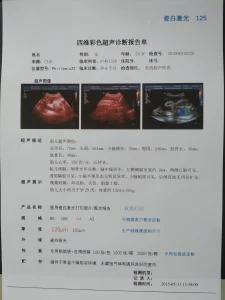 Medical Dry Ultrasound Porcelain White 16K Hospital Film