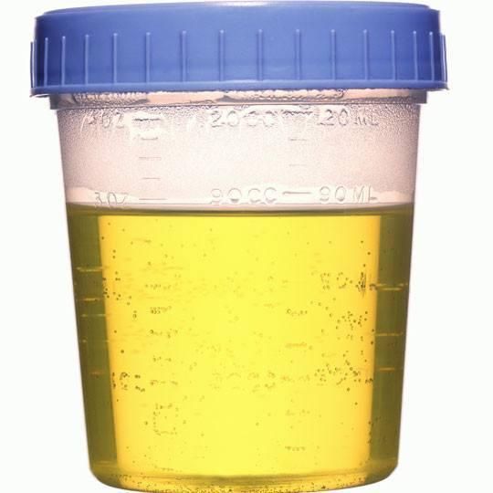 Sterile Urine Specimen Test Cup Container Class I