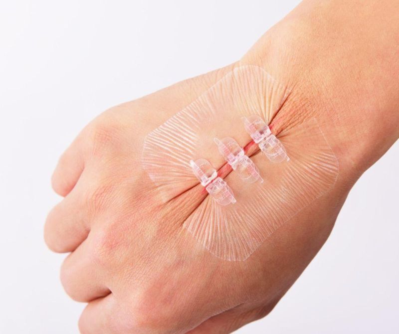 Disposable Disposable Wound Closure Device Plaster for Medical