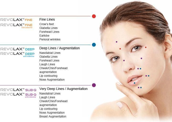 Injectable Hyaluronic Acid Gel Injection 1ml Lip Dermal Filler Hydrogel Injections Deep Pen Perfecta