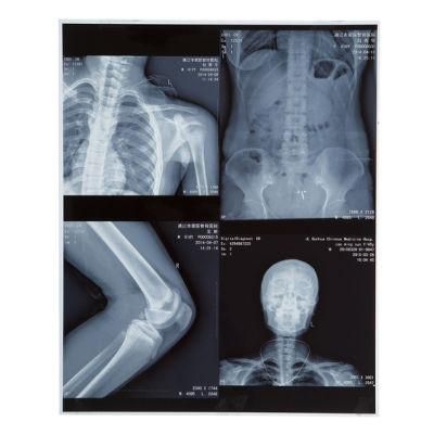 Dr Imaging System Using Inkjet Medical X Ray Films