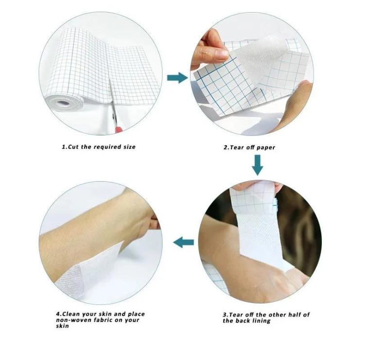 Mdr CE Approved Surgical Adhesive Dressing Tape with a Five-Year Shelf Life
