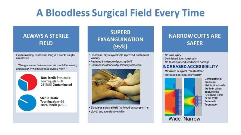 Hot Sale Sterile Exsanguinating Tourniquet Disposible Silicone Tourniquet Hemostatic for Limb Surgical No Need Tourniquet Machine Tourniquet Cuff Esmarch Band