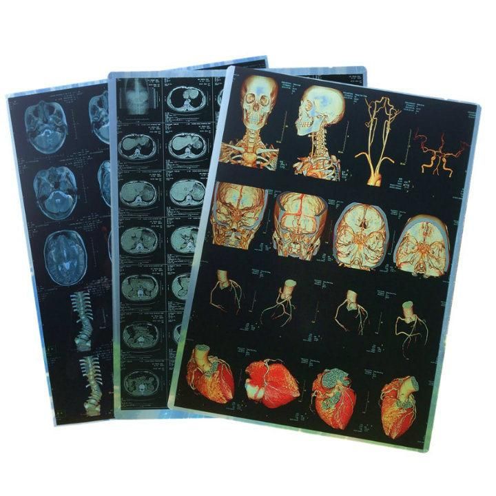 Good Quality Medical Disposables Dry Inkjet Film Medical Paper for Hospital