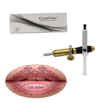 Hyaluronic Acid Dermal Filler for Lip Fullness 10ml