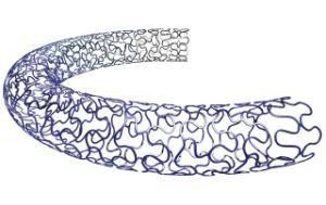 Des Coronary Stent System Stent System