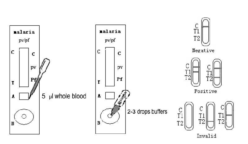 Rapid Malaria Kits Diagnostic Kit One Step Malaria Reagent Test Kit