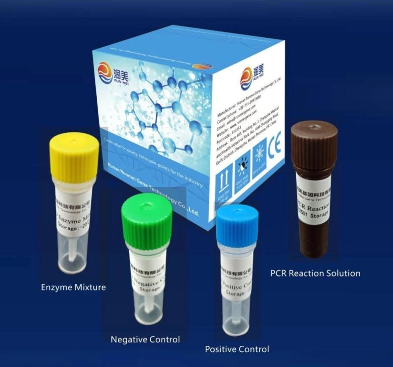 Rna Detection Kit PCR-Fluorescence Probing Virus Nucleic Acid Extraction Test Kit New Infectious Diagnostic Immunodeficiency Antibody Test Antibody Test