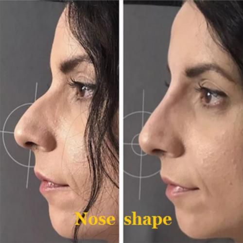 Ha Sodium Hyaluronate Injections with CE Certification
