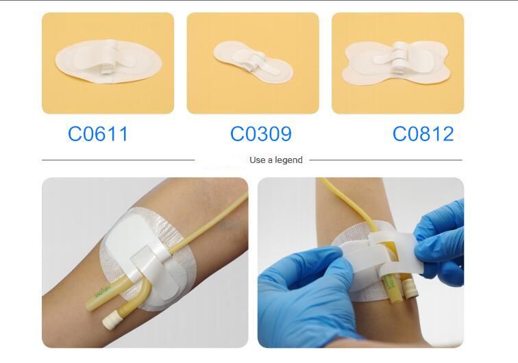 Convenient and Sample Urethral Catheter Fixation Device