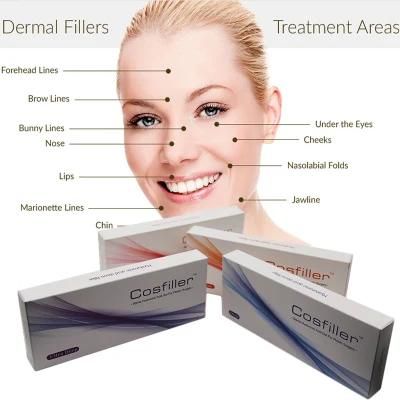 Cross-Linked Injectable Hyaluronic Acid Facial 1ml Deep Dermal Filler for Face Sharpe