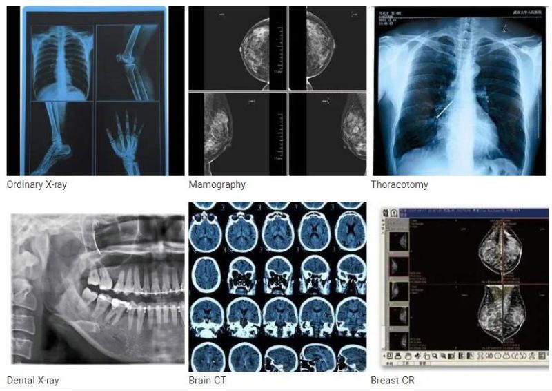 Blue Inkjet Film Professional Production Inkjet Medical X-ray Film