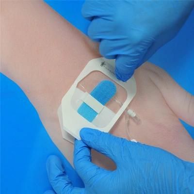 Medical Indwelling Needle IV Set for Securement Fixation Supply Manufacturer