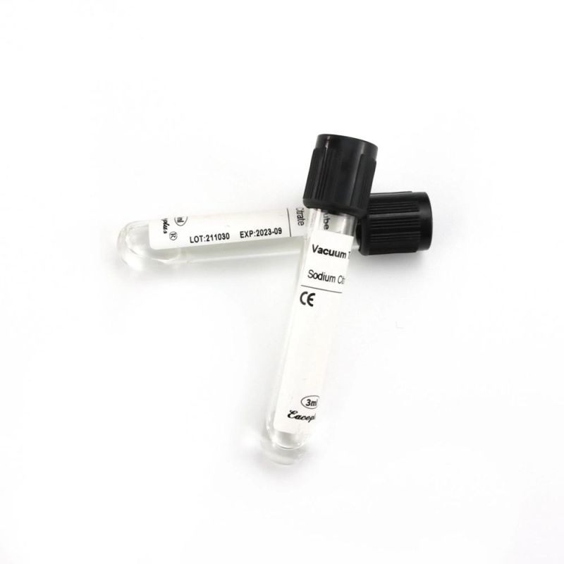 Siny Medical Supply 3.8% Sodium Citrate ESR Disposable Vacuum Blood Collection Tube with CE (2-10ml)