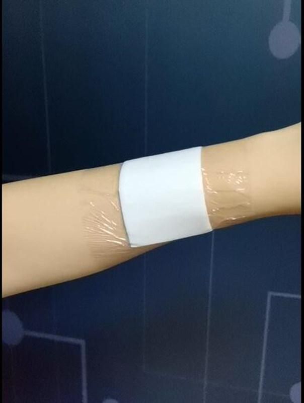 Sterile Post Operation Bacterial and Waterproof Adhesive Wound Dressing Dfco-0260