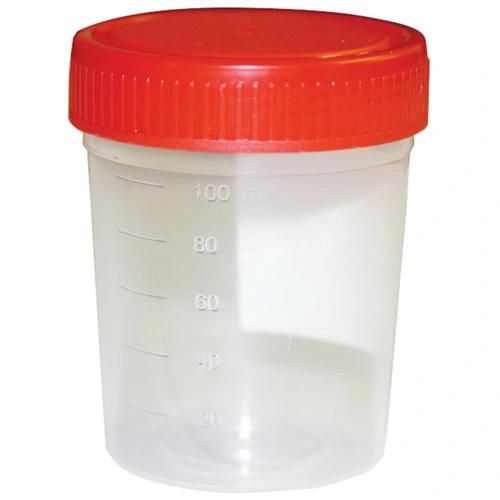 Urine Container/Urine Sample Container/Sample Cup