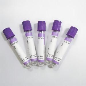 High Quality Good Price 2ml Sterile Sample Vacuum EDTA K2 Blood Collection Test Tubes with Gel