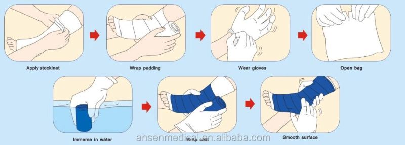Medical Bandage Waterproof Cast Shower Cover Gypsum Plaster of Paris Orthopedic Casting Tape