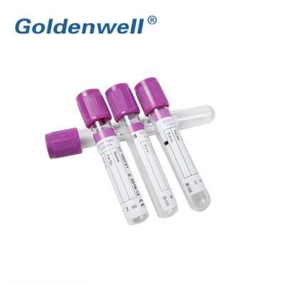 Medical Blood Test Tube Micro Vacuum Blood Collection Tube for Hospital, Laboratory