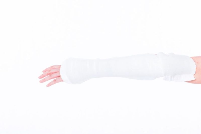 Orthopedic Splint Orthopedic for Legs and Arms Thermoplastic Splint Sheet