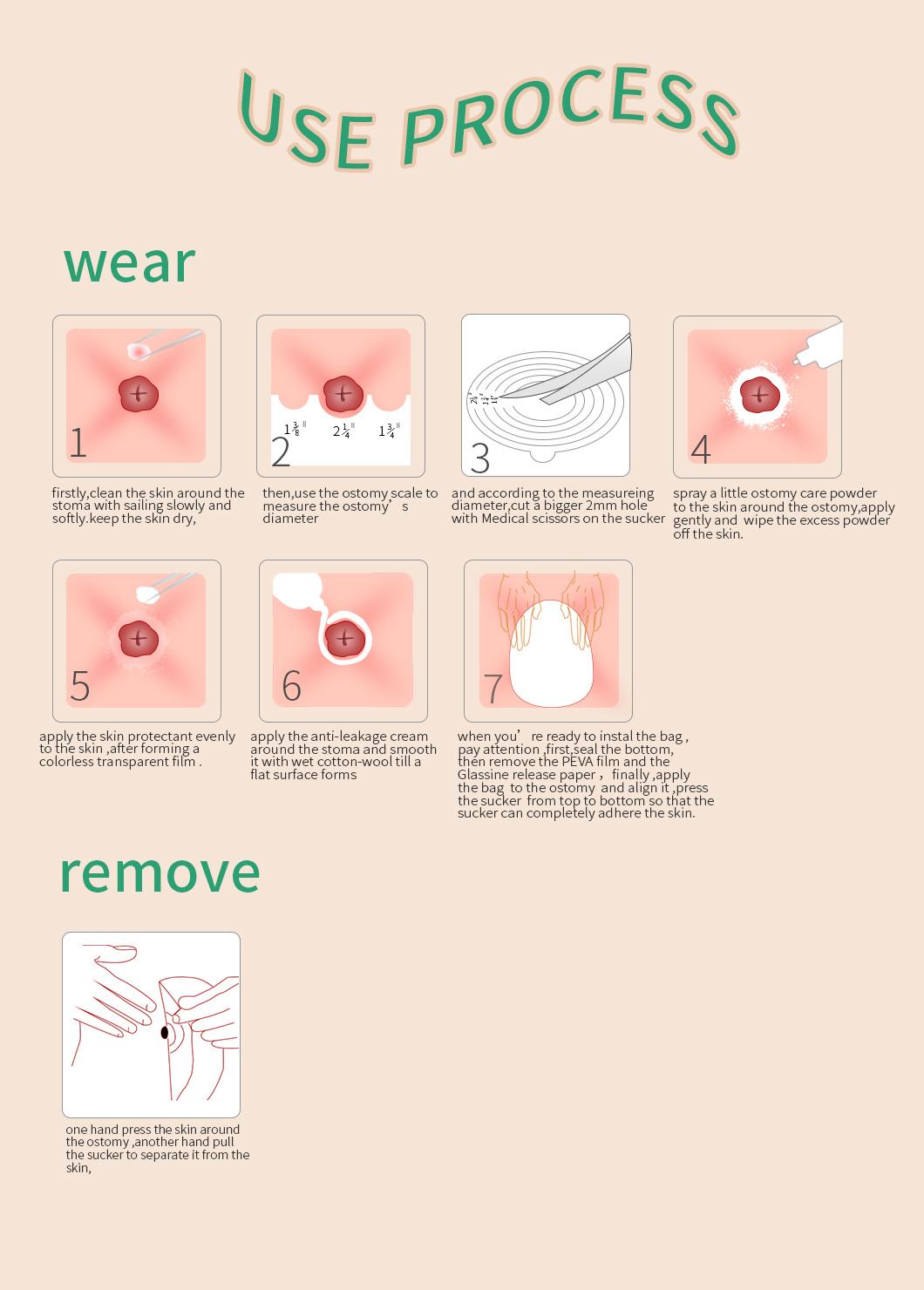 Disposable One Piece Closed Pouch Ostomy Bag
