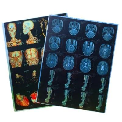 Cheap Price Double X Ray Blue Film with Dicom Cr CT Scan MRI Equipment