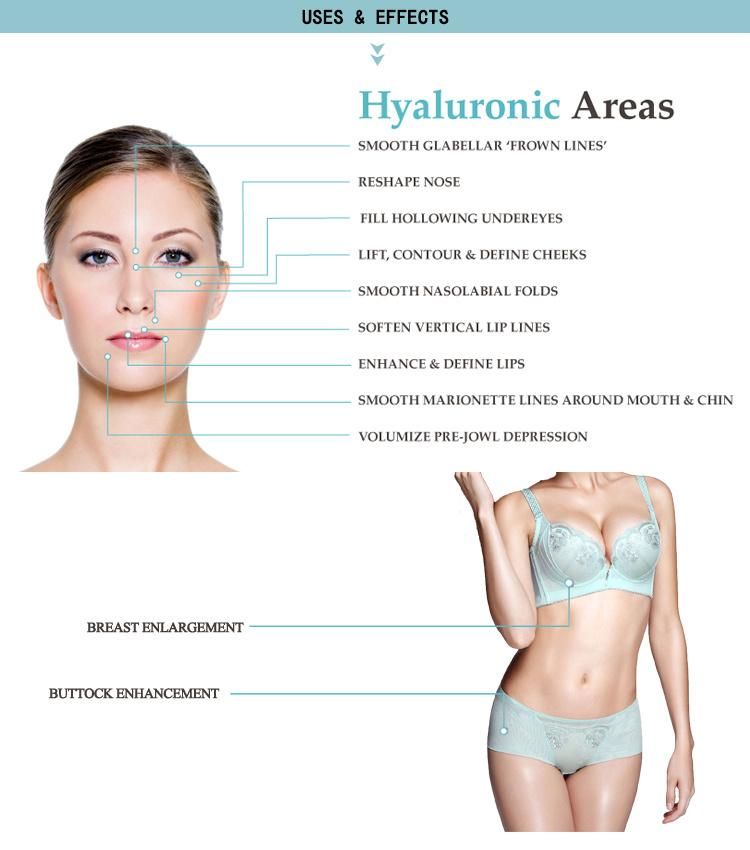 Hyaluronic Acid Injection Dermal Filler with Lidocaine