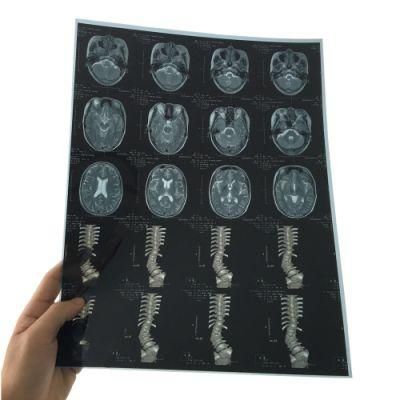Blue Inkjet Mammogram X-ray Films