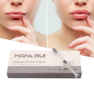 Absolutely Safe for Use in The Face Ha Filler Lip Filler Hyaluronic Acid Gel