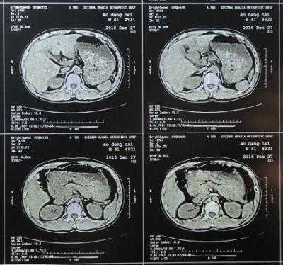 Hospital Ultrasound Dept. and Radiology Dept. Blue Medical Dry Film