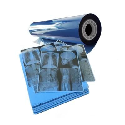 Digital X Ray Film Soft Ware Dicom Print Meidcal Blue Positive Pet Film for CT Cr Dr MRI
