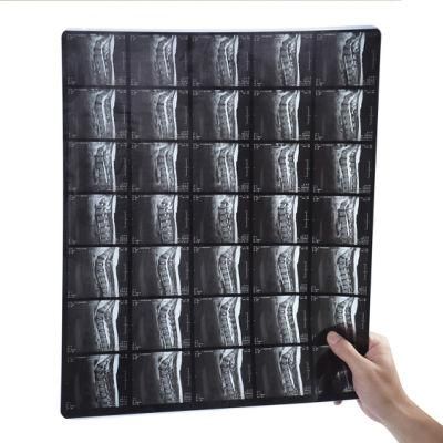 8X10 A3 A4 Pet Radiology 210um Blue Inkjet Digital Medical Xray Film