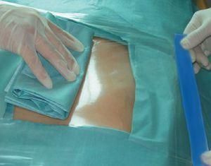 Disposable Transparent PU Surgical Film with Iodine