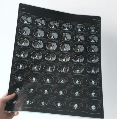 Cheap Blue Medical Digital X-ray Film for Agfa and FUJI Xerox Printer