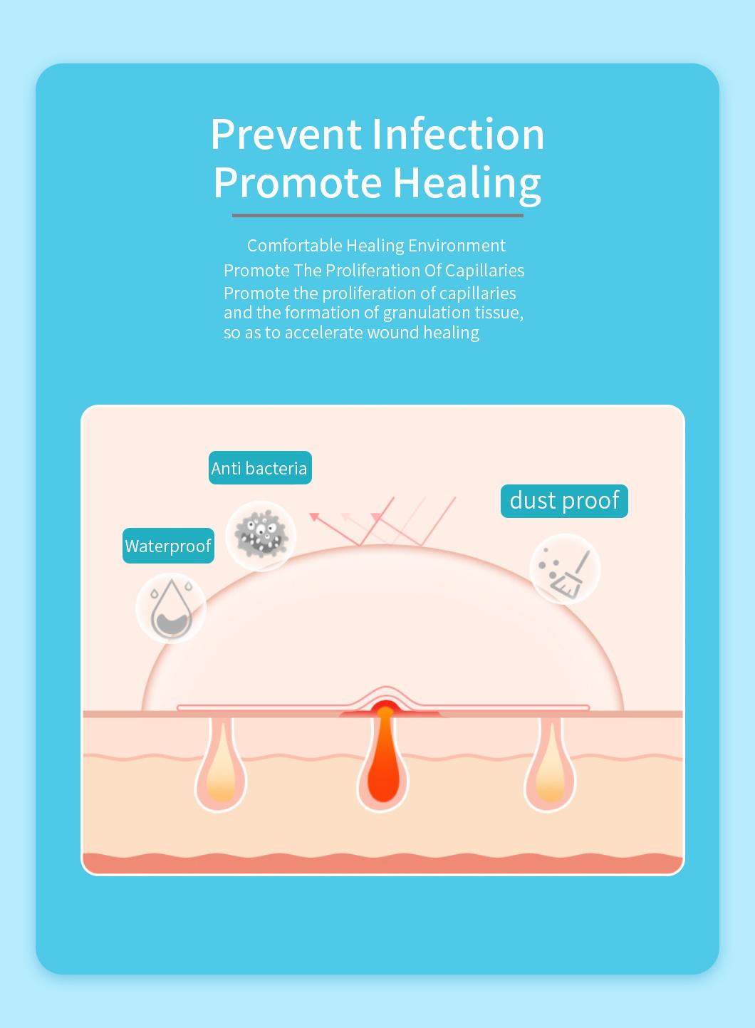 Hydrocolloid Dressing Absorb Exudates Wound