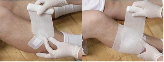 Mdr CE Approved PBT Gauze Light Elastic Bandage First Aid Medical Conforming Polyester Bandage