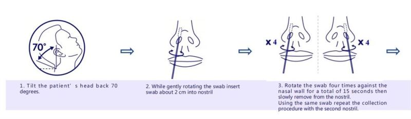 Anterior Nasal Swab Disposable Rapid Antigen Test Kit Diagnostic Self Test Kit