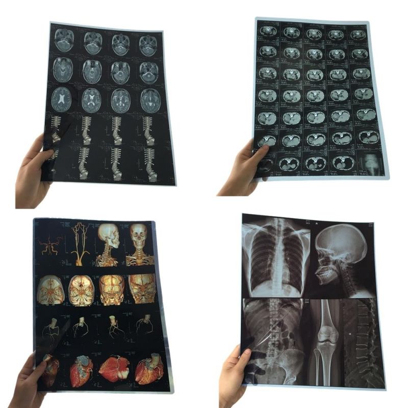 Roll Packing Medical Inkjet Cheap MRI X Ray Films