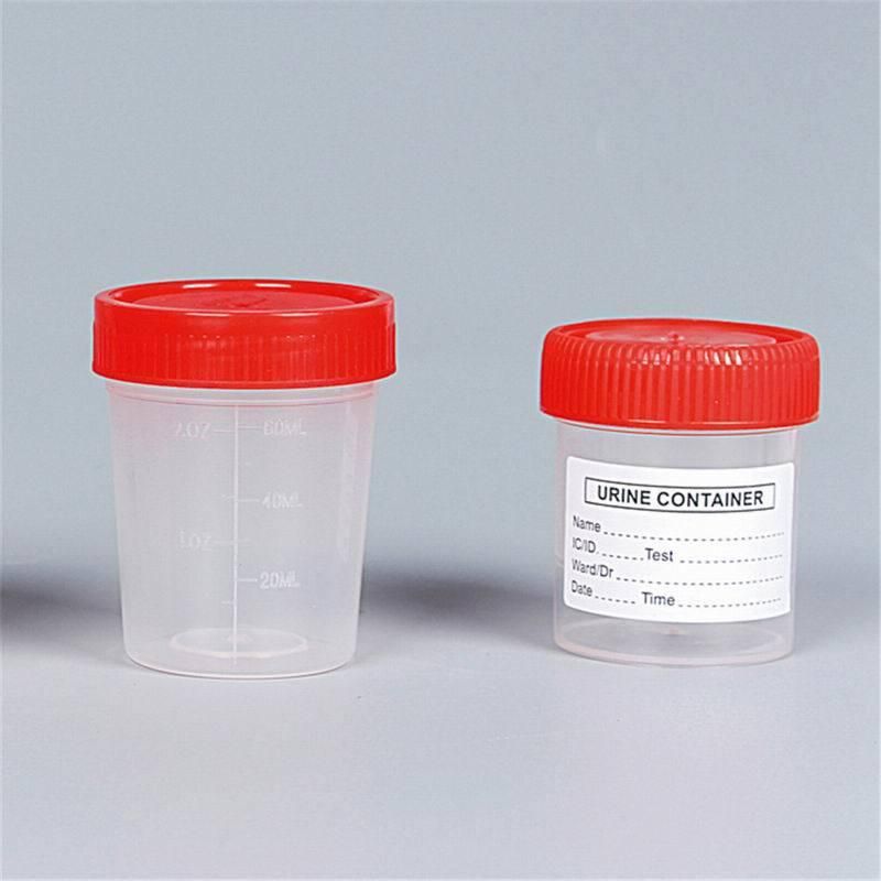 Stool Container with Spoon Disposable Test Use with Label Urine and Stool Container