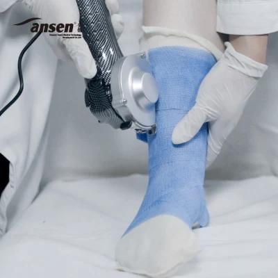 Medical Consumables Korea Bandage Water Cured Orthopedic Fiberglass Casting Tape
