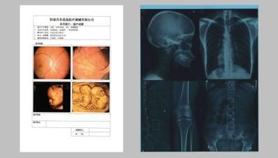 Inkjet Medical X Ray Blue/White Film