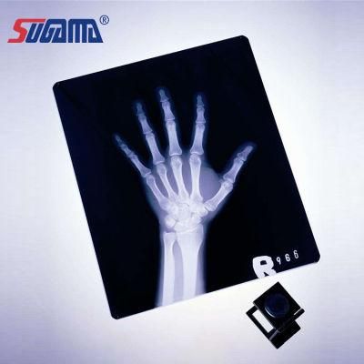 10*12 Inch Blue Sensitive Medical X-ray Dry Films