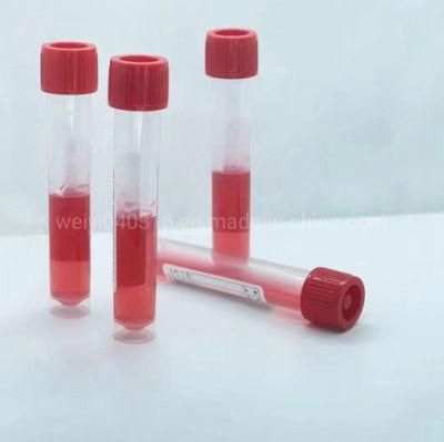 Disposable Virus Specimen Collection Tube with Inactivated/Activated Media &Flocked Swab Diagnostic Kit