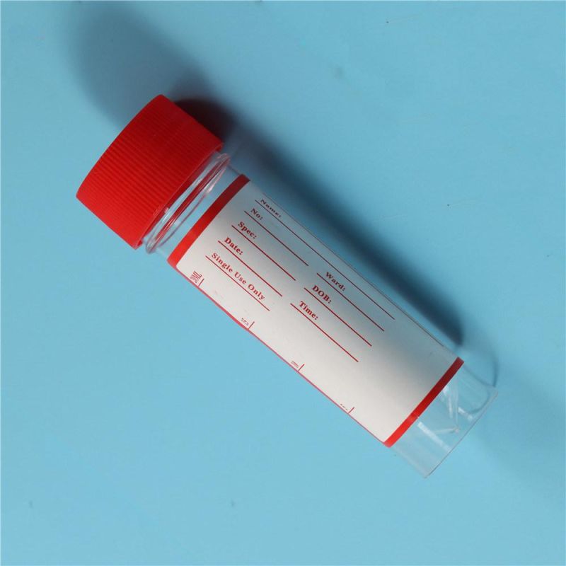 Stool Container with Spoon Disposable Test Use with Label Urine and Stool Container