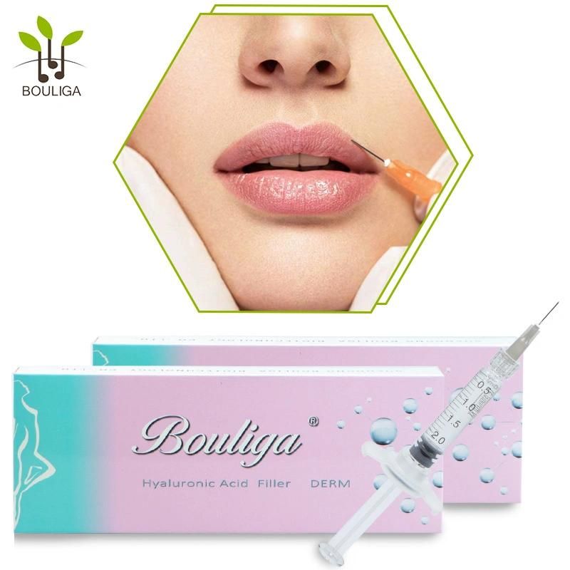 Hyaluronic Acid Dermal Filler Injections Lip Enlargement Filler Deep 2ml