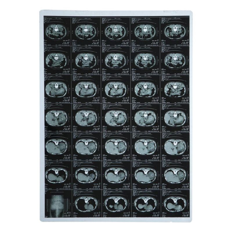 Blue and White Dry Ultrasound Films