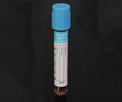 Vtm Kits Nasopharyngeal Swab Oropharyngeal Swab Plastic Disposable Virus Sampling Tube